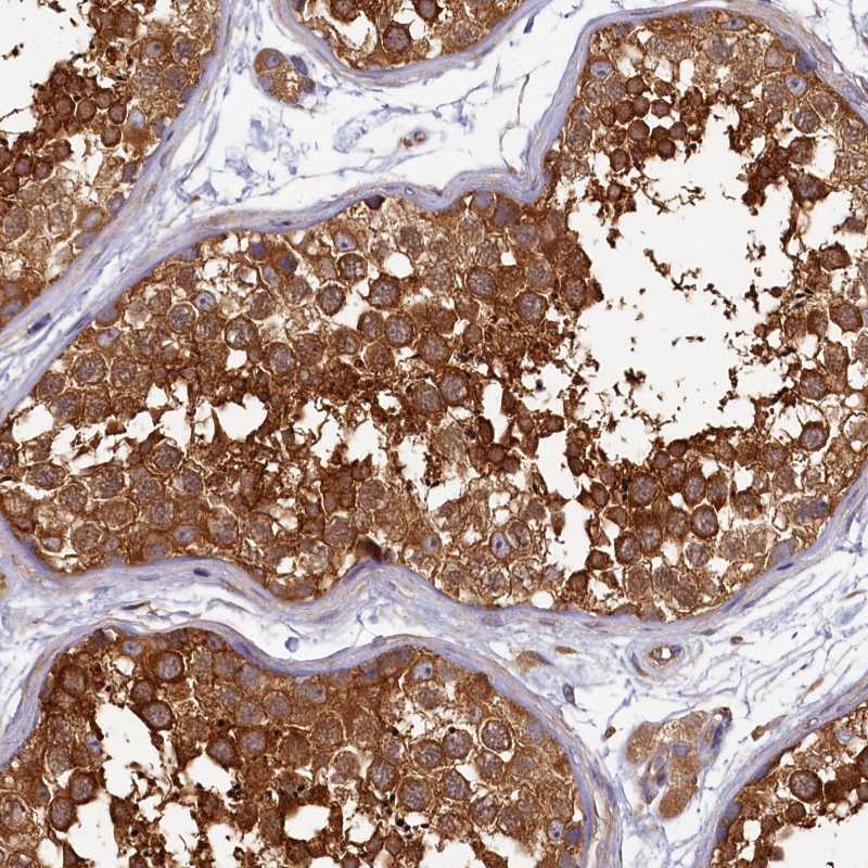 Anti-PPIP5K1 Antibody