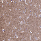 Immunohistochemical staining of human cerebral cortex shows strong cytoplasmic positivity in neuropil.