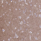 Immunohistochemical staining of human cerebral cortex shows strong cytoplasmic positivity in neuropil.
