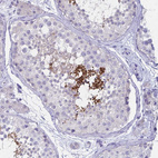 Anti-SH3GL3 Antibody