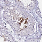 Immunohistochemical staining of human testis shows strong cytoplasmic positivity in a subset of cells in seminiferous ducts.