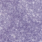 Immunohistochemical staining of human tonsil shows no positivity in non-germinal center cells as expected.