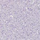 Immunohistochemical staining of human liver shows no positivity in hepatocytes as expected.