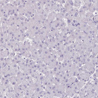 Anti-SH3GL3 Antibody