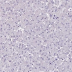 Immunohistochemical staining of human liver shows no positivity in hepatocytes as expected.