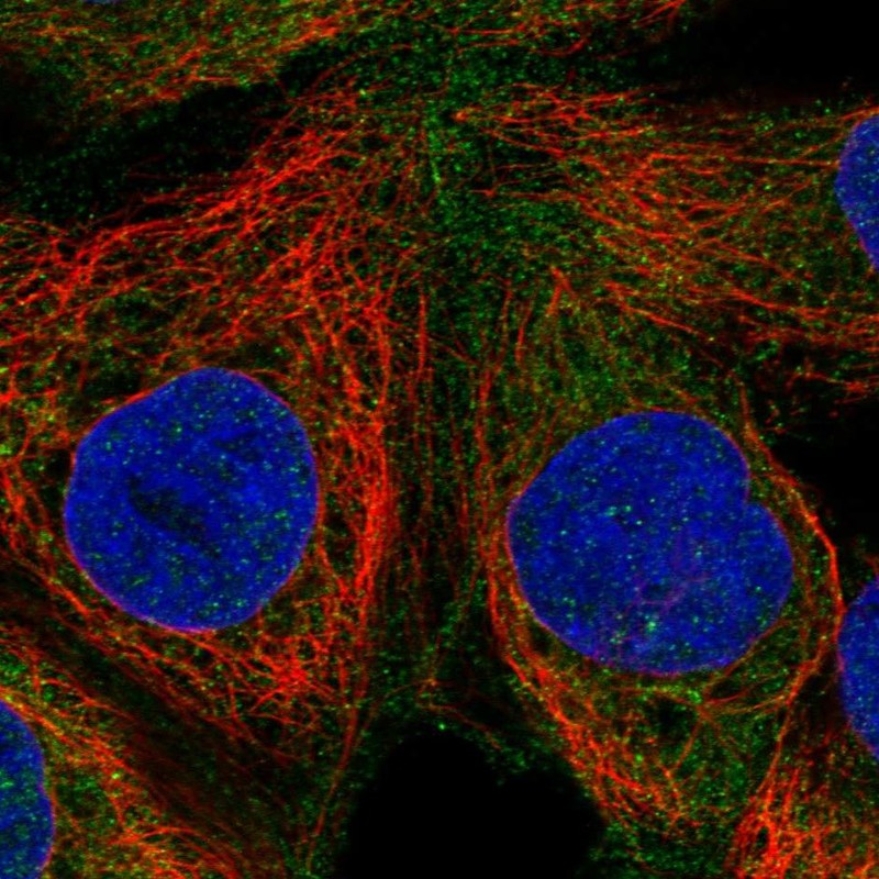 Anti-RASGRP1 Antibody