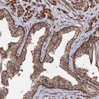 Anti-CEP76 Antibody