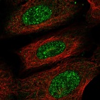 Immunofluorescent staining of human cell line U-2 OS shows localization to nucleoplasm.