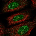 Immunofluorescent staining of human cell line U-2 OS shows localization to nucleoplasm.