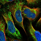 Immunofluorescent staining of human cell line U-2 OS shows localization to plasma membrane & mitochondria.