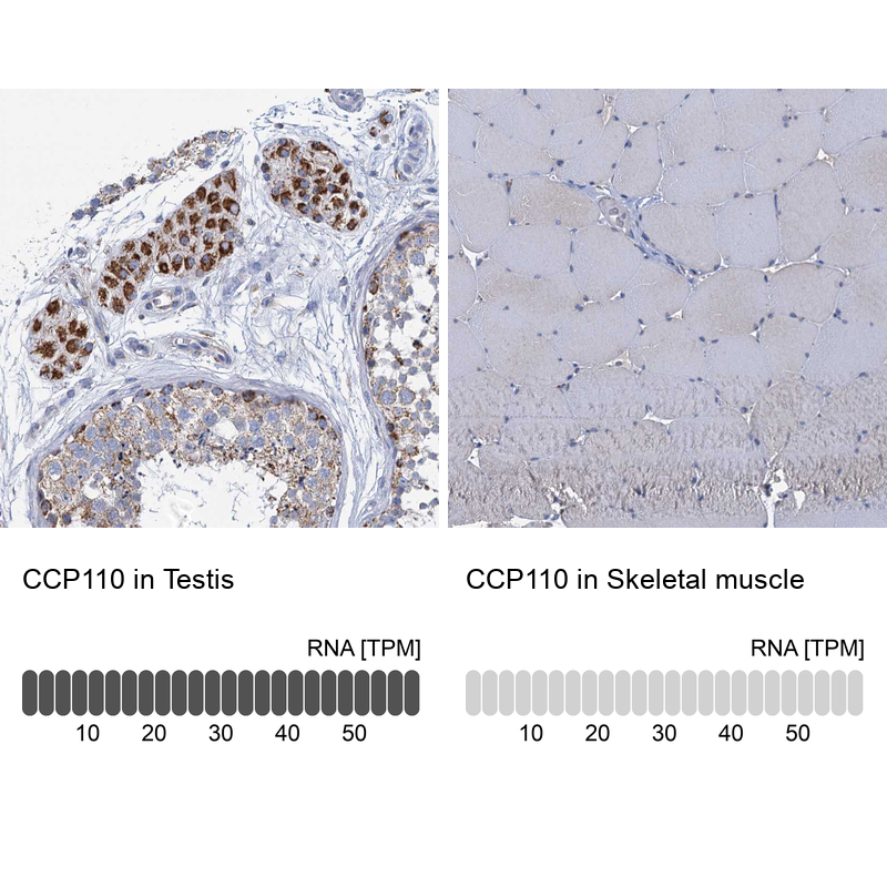 Anti-CCP110 Antibody