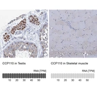 Anti-CCP110 Antibody