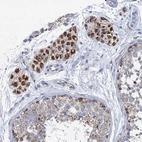 Immunohistochemical staining of human testis shows strong cytoplasmic positivity in Leydig cells.