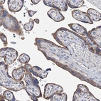 Immunohistochemical staining of human placenta shows moderate cytoplasmic positivity in trophoblastic cells.