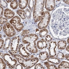Immunohistochemical staining of human kidney shows moderate cytoplasmic positivity in cells in tubules.