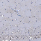 Immunohistochemical staining of human skeletal muscle shows no positivity in myocytes as expected.