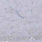 Immunohistochemical staining of human skeletal muscle shows no positivity in myocytes as expected.