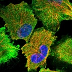 Immunofluorescent staining of human cell line U-251 MG shows localization to plasma membrane & cytosol.