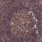 Anti-HAUS8 Antibody