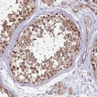 Anti-UBE3A Antibody