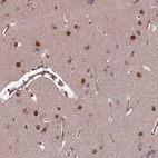 Immunohistochemical staining of human Cerebral cortex shows moderate nuclear and cytoplasmic positivity in neuronal and glial cells.