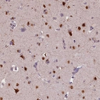 Immunohistochemical staining of human cerebral cortex shows strong nuclear positivity in neurons.