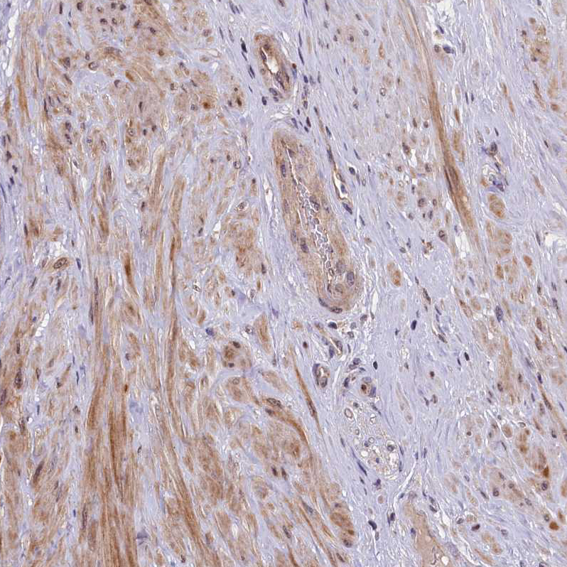 Rabbit Polyclonal AntiUBE3A Antibody Buy for research Highly