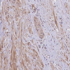 Immunohistochemical staining of human prostate shows moderate cytoplasmic positivity in smooth muscle cells.