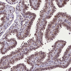 Immunohistochemical staining of human fallopian tube shows moderate nuclear positivity in glandular cells.