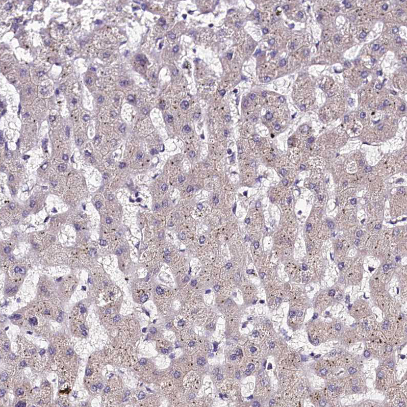 Rabbit Polyclonal AntiUBE3A Antibody Buy for research Highly