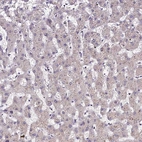 Immunohistochemical staining of human liver shows no cytoplasmic positivity in hepatocytes.