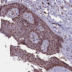 Immunohistochemical staining of human skin shows moderate nuclear positivity in squamous epithelial cells.
