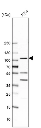 Western blot analysis in human cell line RT-4.