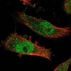 Immunofluorescent staining of human cell line U-251 MG shows localization to nucleoplasm & cytosol.