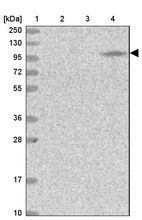 Lane 1: Marker [kDa] 250, 130, 95, 72, 55, 36, 28, 17, 10_br/_Lane 2: Human cell line RT-4_br/_Lane 3: Human cell line U-251MG sp_br/_Lane 4: Human plasma (IgG/HSA depleted)