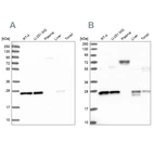 Western blot analysis using Anti-MESDC2 antibody HPA039414 (A) shows similar pattern to independent antibody HPA041721 (B).