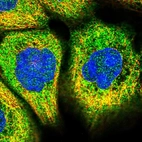 Immunofluorescent staining of human cell line A-431 shows localization to cytosol.
