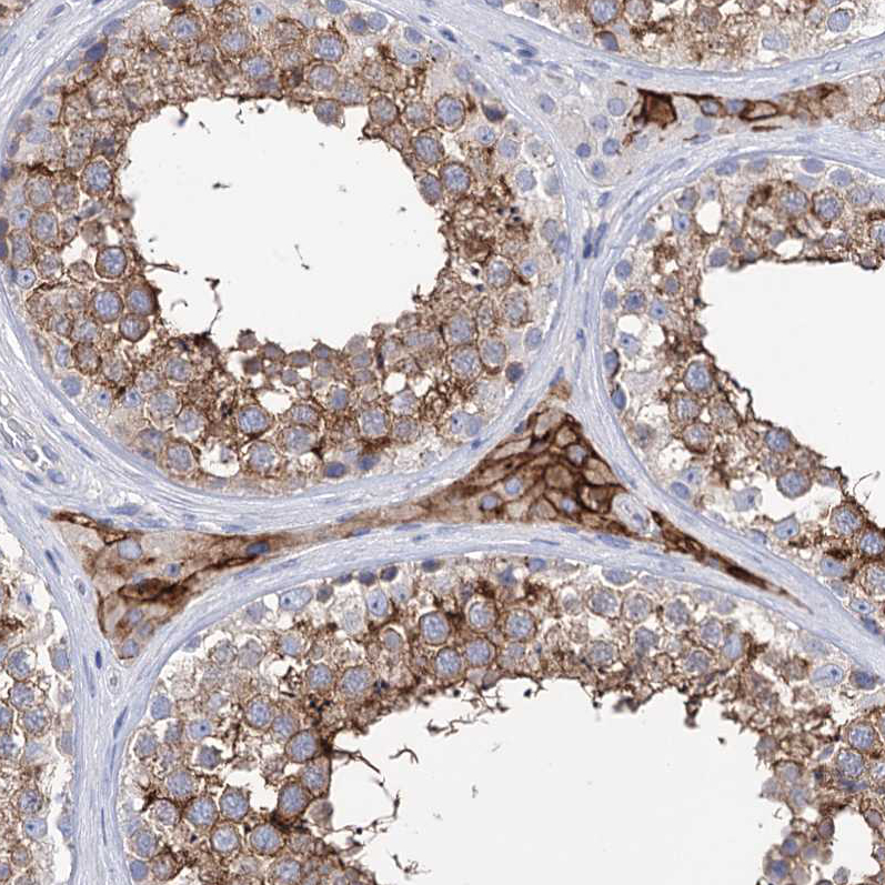 Anti-BBS4 Antibody