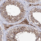 Anti-BBS4 Antibody