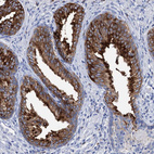 Immunohistochemical staining of human prostate shows strong cytoplasmic and membranous positivity in glandular cells.