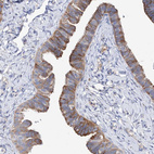 Immunohistochemical staining of human Fallopian tube shows moderate membranous and cytoplasmic positivity in glandular cells.