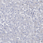 Immunohistochemical staining of human liver shows no positivity in hepatocytes as expected.