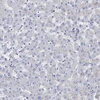 Immunohistochemical staining of human liver shows no positivity in hepatocytes as expected.