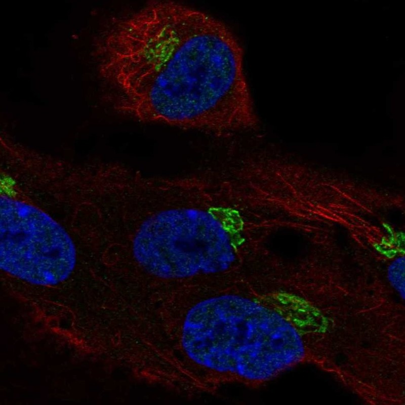 Anti-LRRC43 Antibody