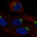 Anti-LRRC43 Antibody
