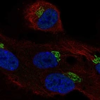 Anti-LRRC43 Antibody