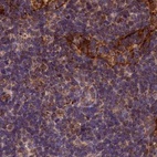 Anti-SPRYD3 Antibody
