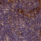 Immunohistochemical staining of human lymph node using Anti-SPRYD3 antibody HPA039426.