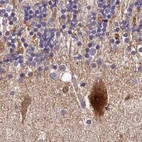 Immunohistochemical staining of human cerebellum using Anti-SPRYD3 antibody HPA039426.