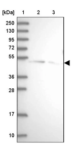 Lane 1: Marker [kDa] 250, 130, 95, 72, 55, 36, 28, 17, 10_br/_Lane 2: Human cell line RT-4_br/_Lane 3: Human cell line U-251MG sp